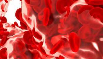 Sepsis Benefits and side effects of Beer