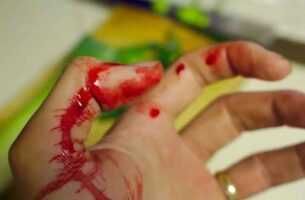 trauma-e-sua-gestão-dietética