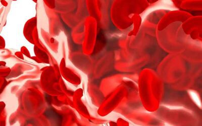 Sepse e seu manejo alimentar completo