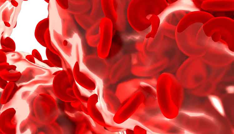 Sepsis and Its Complete Dietary Management