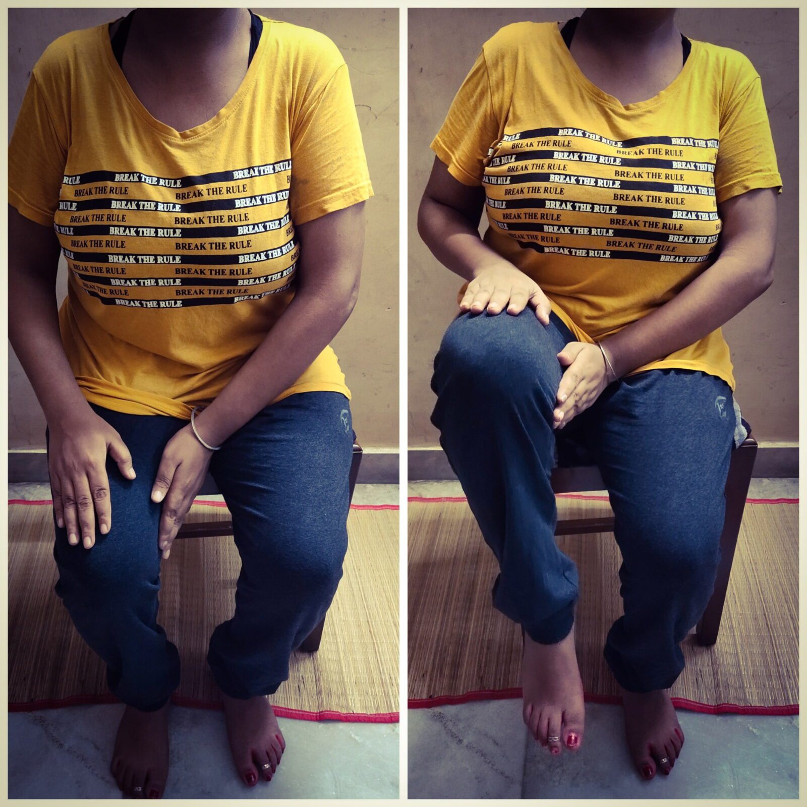 Hip Flexion with Hold Paralysis Treatment