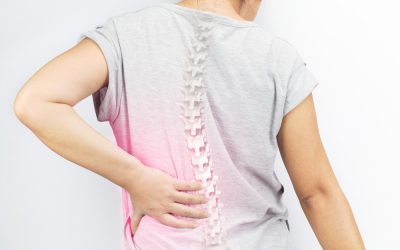 Ankylosing spondylitis pada wanita: penyebab, gejala dan pengobatan