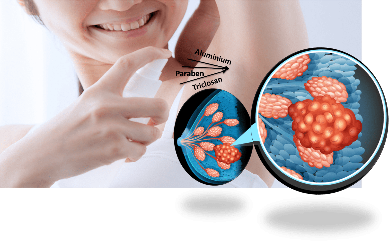 Deodoran menyebabkan kanker payudara