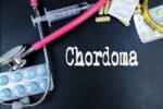 Chordoma Tailbone: Symptoms, Causes and Treatment