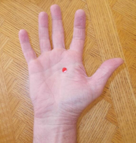 Pericardium 8 Points