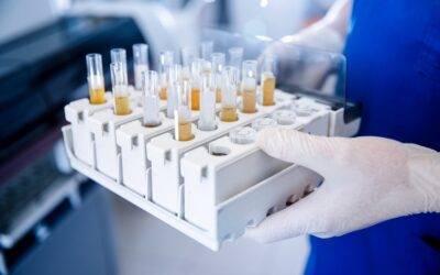 Apakah urin menahan DNA: Apa yang dikatakan para ahli?