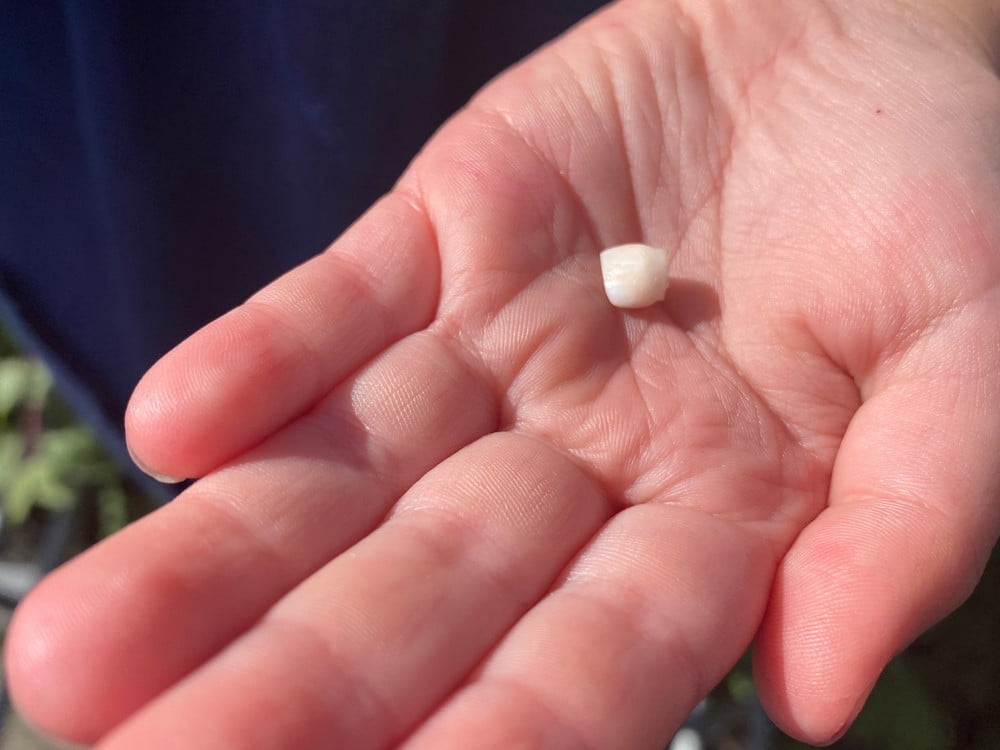 Mahkota permanen jatuh