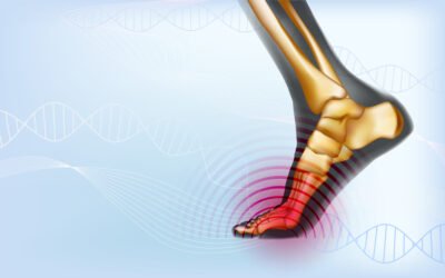 5 exercícios incríveis de sesamoidite 5 exercícios incríveis de sesamoidite