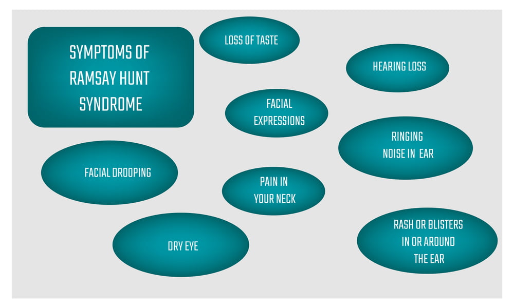Ramsay Hunt Syndrome Natural Treatment