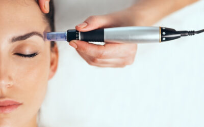 Apa yang Harus Dimasukkan pada Kulit Setelah Microneedling : Saran Ahli