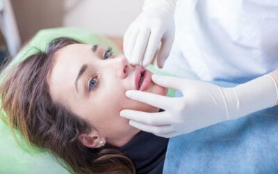 Lip Filler Migration: Massage and How to Prevent Lip Filler Migration: Massage and How to Prevent