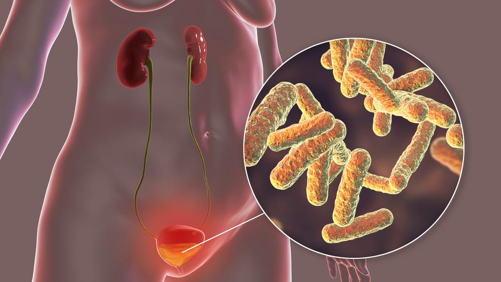infecção no banheiro