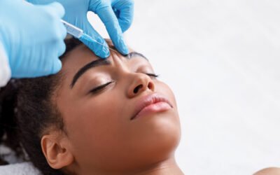 Botox antes e depois: coisas importantes que você precisa saber