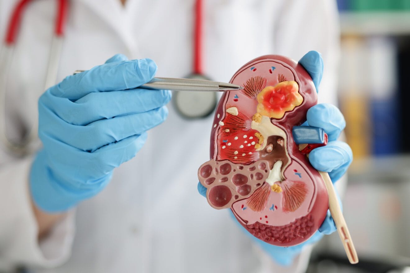 Creating a Healthy Renal Diet Plan: Breakfast, Lunch, and Dinner Ideas ...