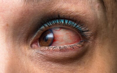 تمارين التهاب القزحية: تقنيات فعالة لإدارة الالتهاب وتعزيز الرؤية