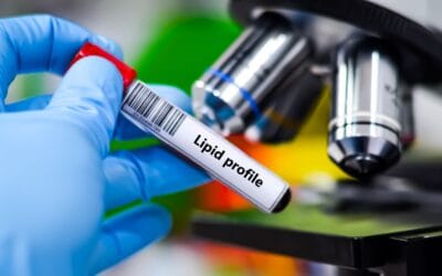 محلل اختبار الدهون