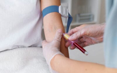 محلل اختبار الكلى