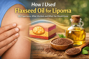 Flaxseed Oil for Lipoma