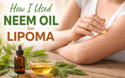 How I Used Neem Oil for Lipoma: My Honest Experience (What Worked & What Didn’t) Neem Oil for Lipoma