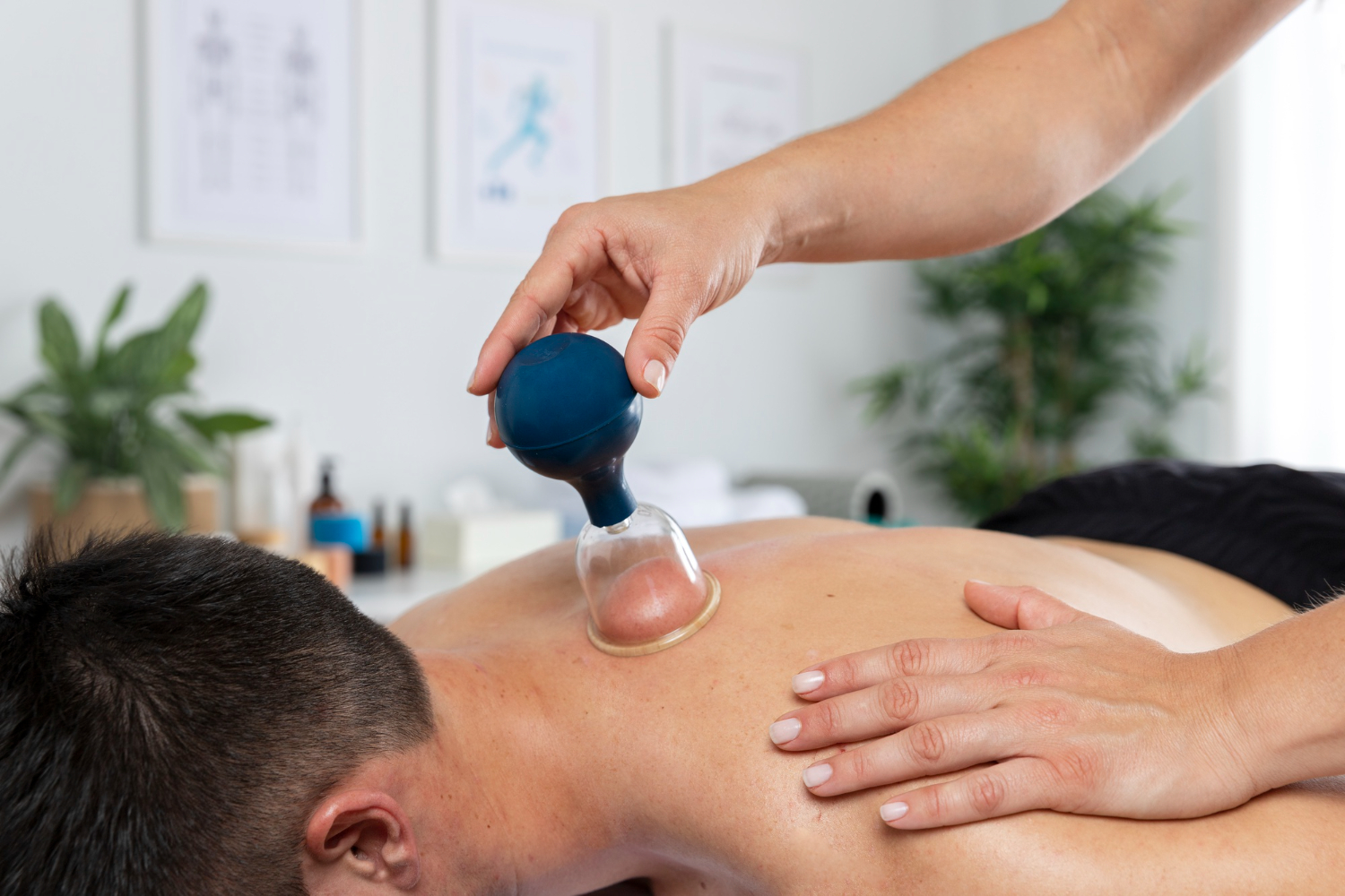 Cupping therapy at home